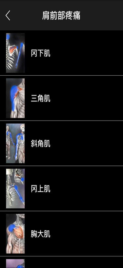 肌肉激痛點