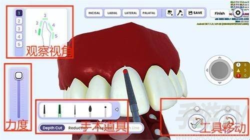 牙医模拟器